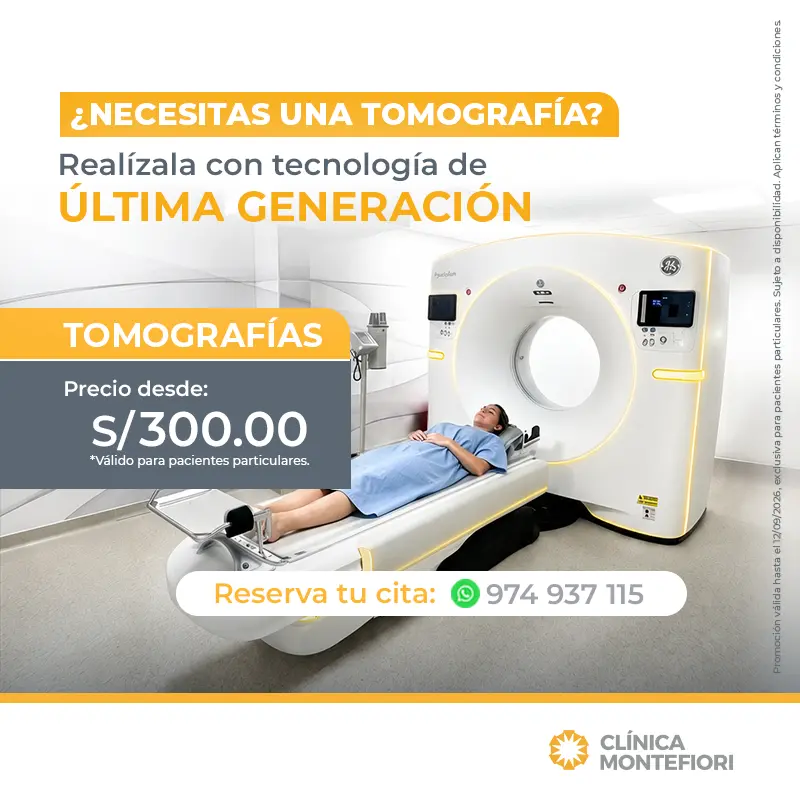 Promoción